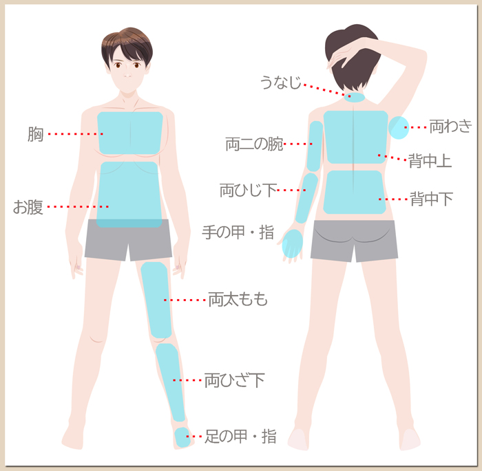 ボディ脱毛部位.jpg